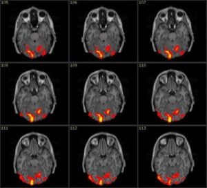 9 immagini di cervello sottoposto a risonanza magnetica mostrano diverse risposte allo stimolo bicchiere coca cola o bicchiere pepsi cola