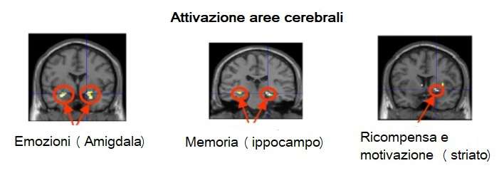 tre esempi di scansione cerebrale con fMRI: la prima mostra attivazione amigdala (emozioni), la seconda ippocampo (memoria) e la terza striato (ricompensa e motivazione)