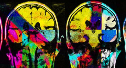 Neuroestetica: capire l’arte tramite le neuroscienze